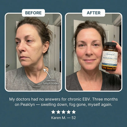 Peaklyn L-Lysine + Monolaurin For EBV